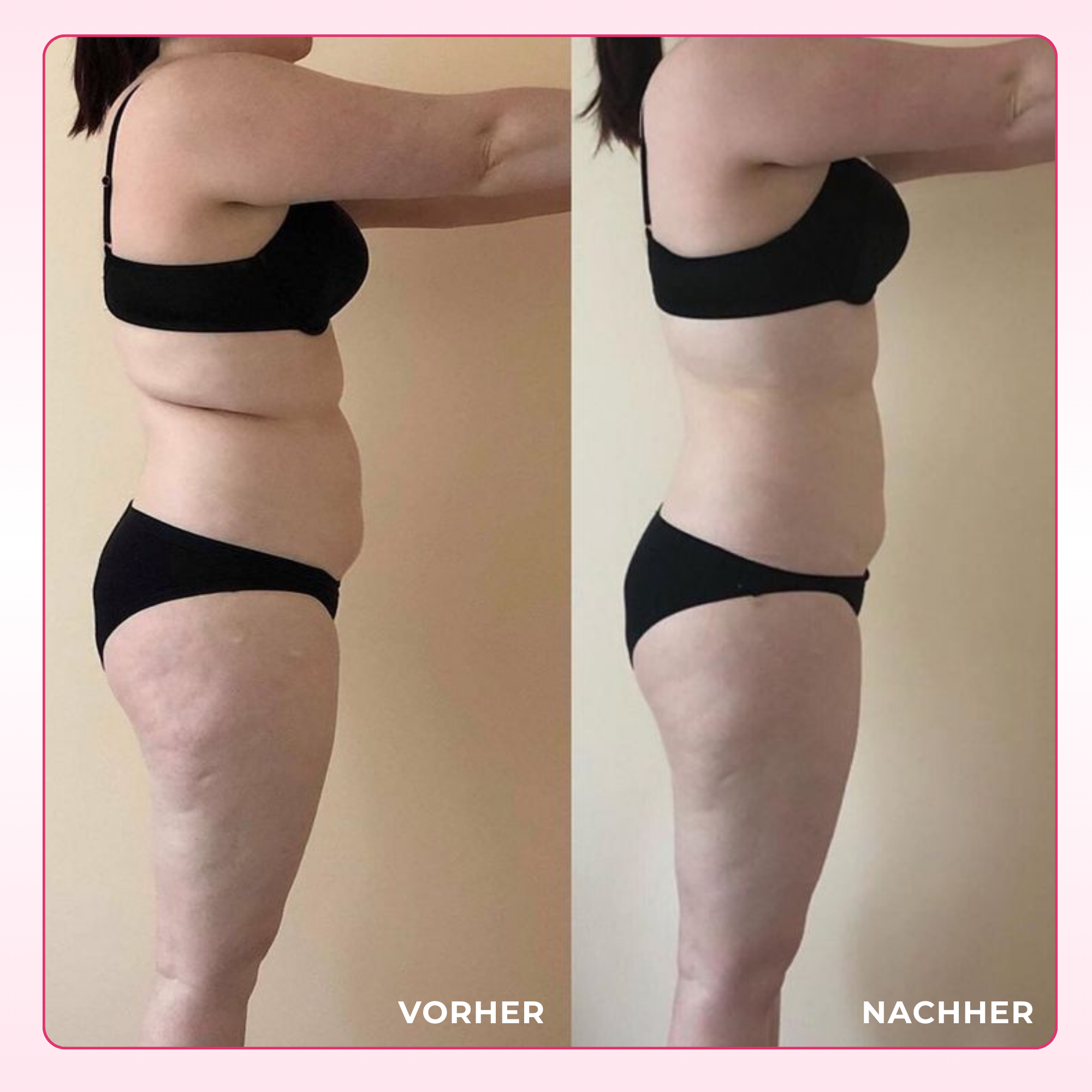 SLIMGLOW FETTVERBRENNER