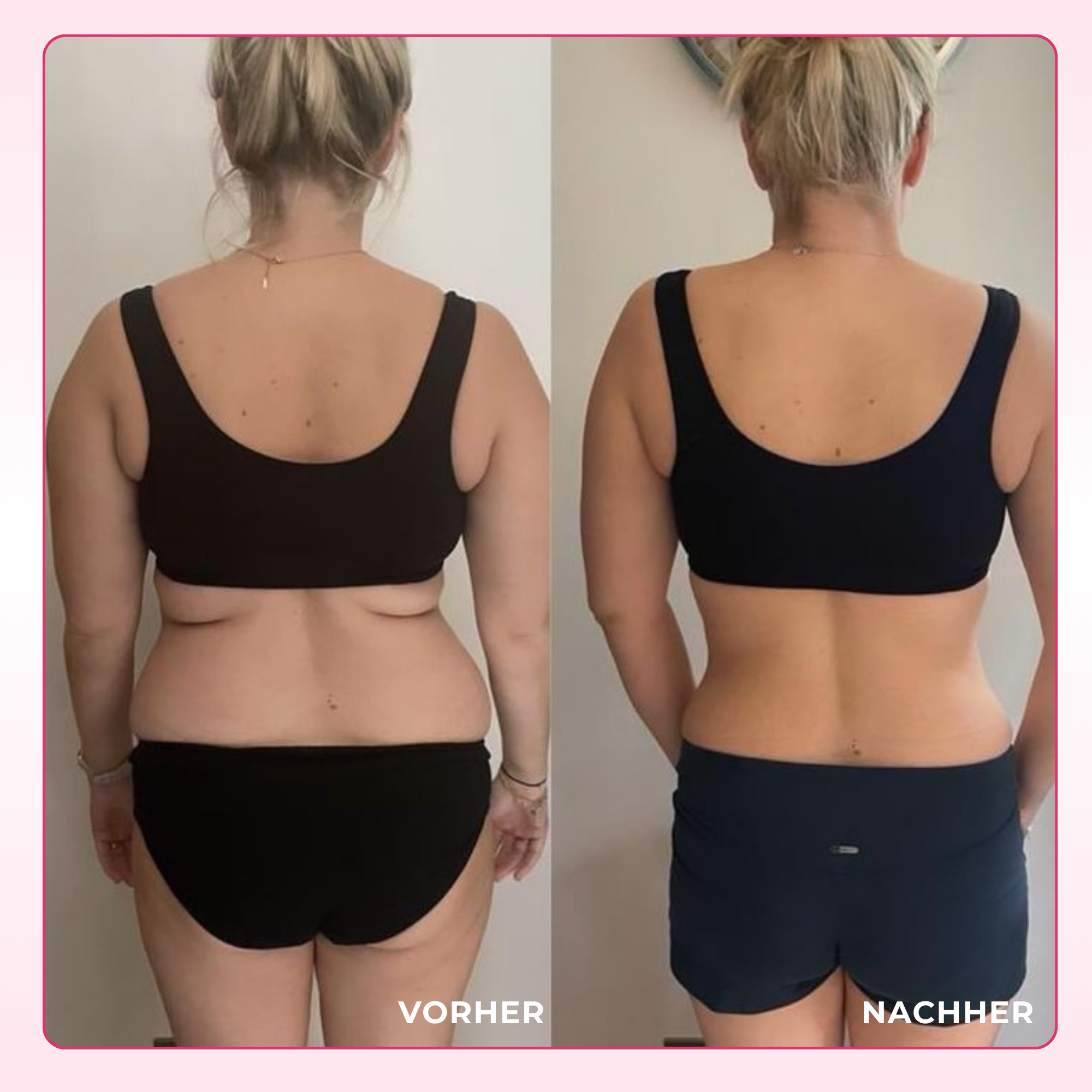 SLIMGLOW FETTVERBRENNER